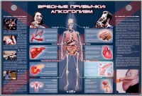 Электрифицированный стенд "Вредные привычки: алкоголизм" - «globural.ru» - Салават
