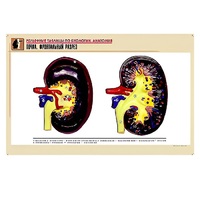 Рельефная таблица "Почка. Фронтальный разрез" (формат А1, матовое ламинир.) - «globural.ru» - Салават